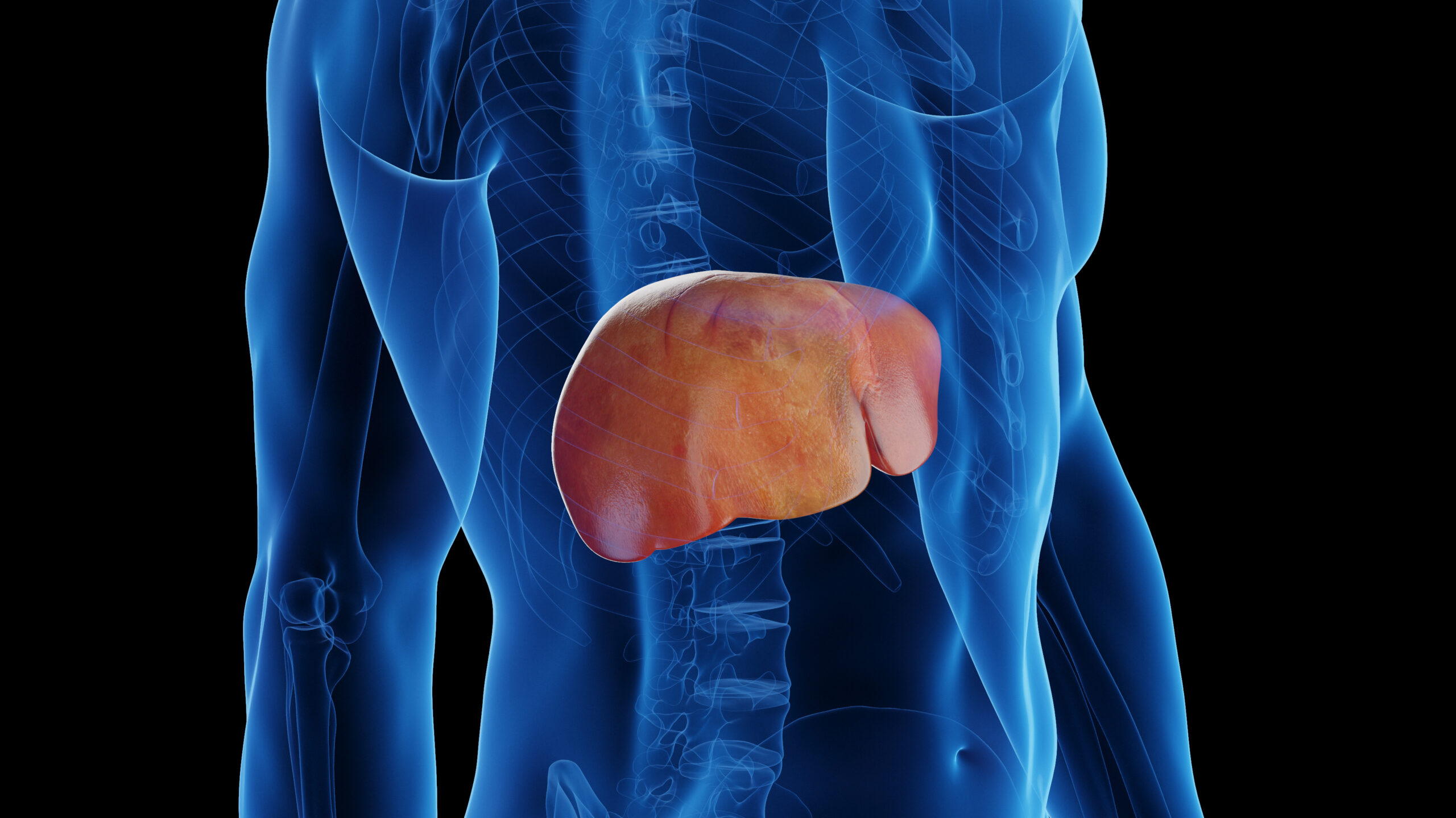 Fatty Liver: Understanding, Preventing, and Treating One of the Fastest Growing Health Concerns